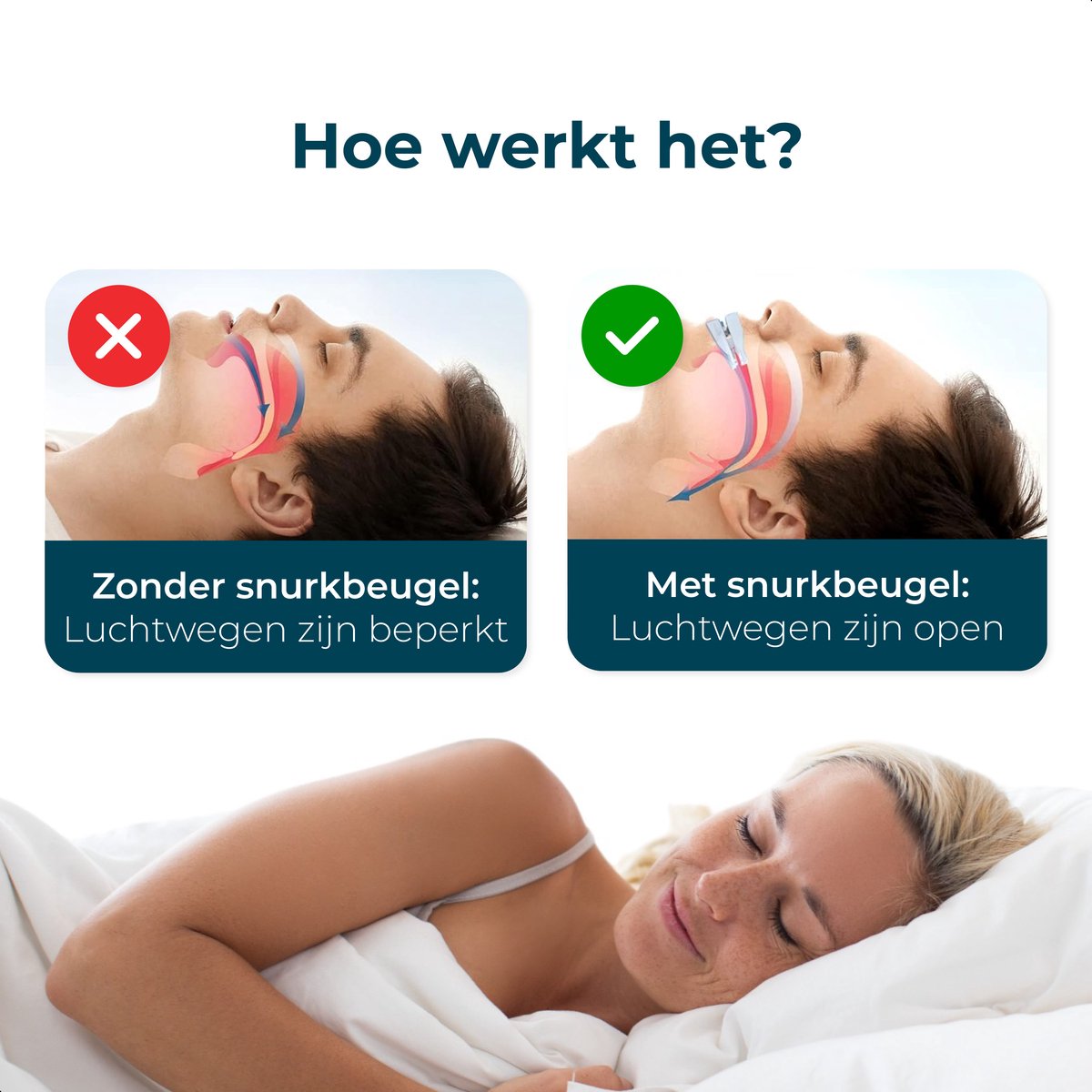 Anti Snurk Beugel - 2 PACK