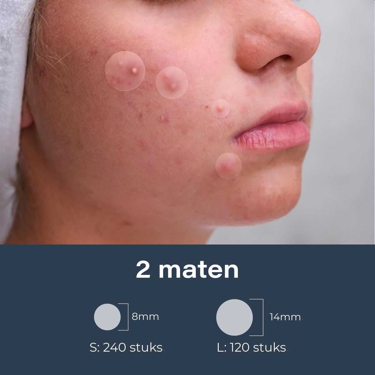 Vimora Pimple Patches - 360 stuks