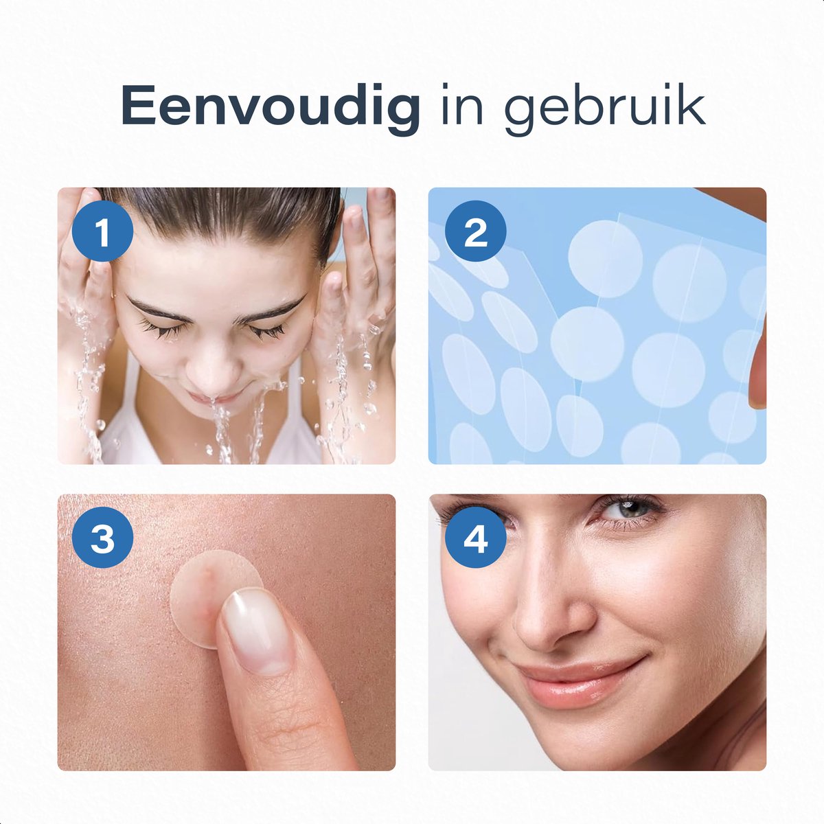 Vimora Pimple Patches - 360 stuks